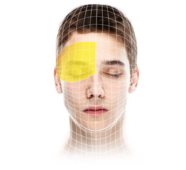 Cluster headache