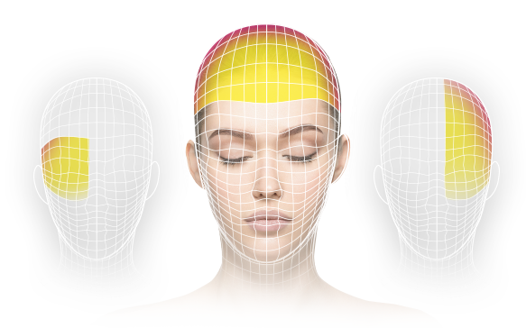 Types of headache